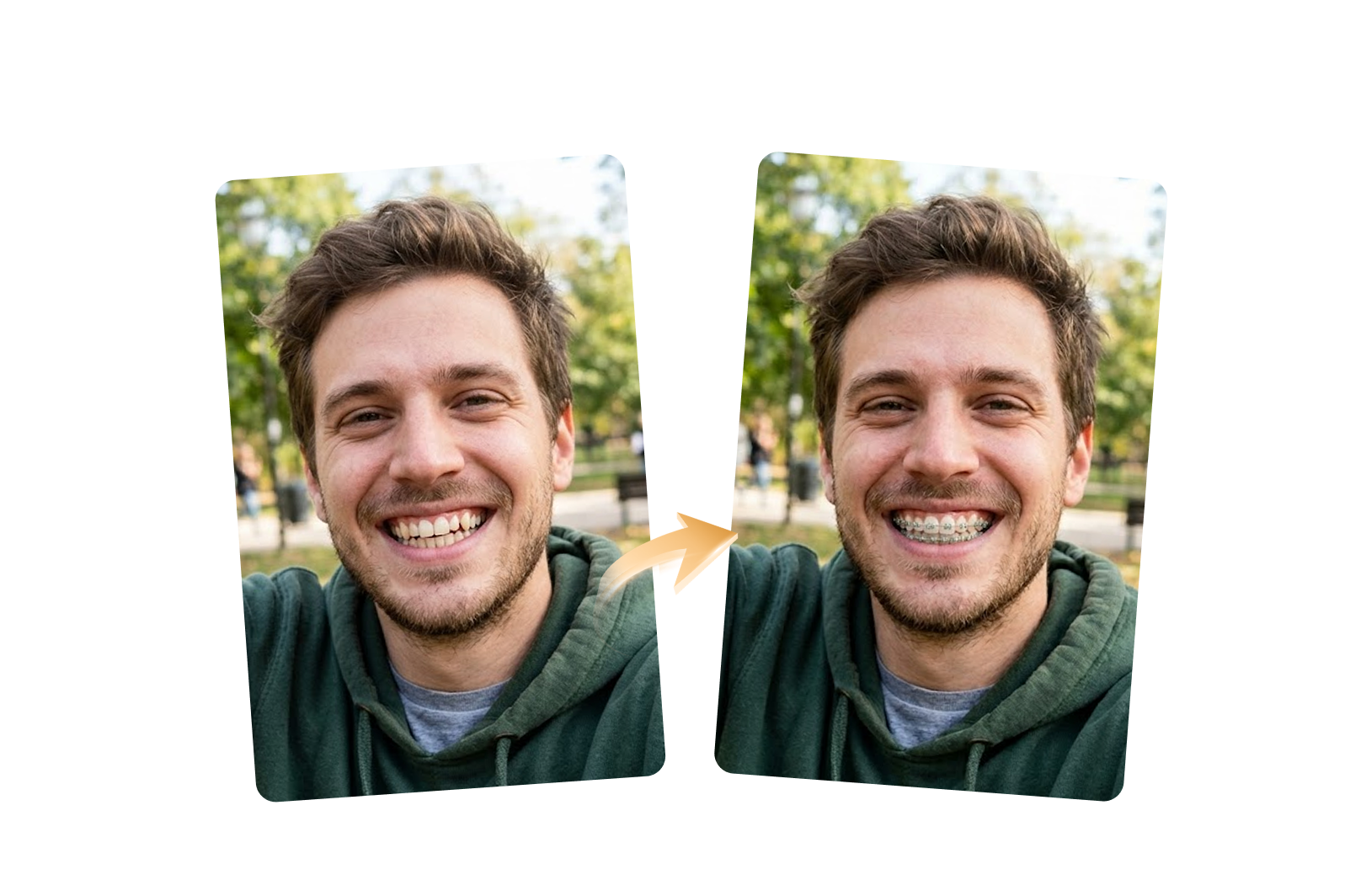 ai braces filter bottom banner