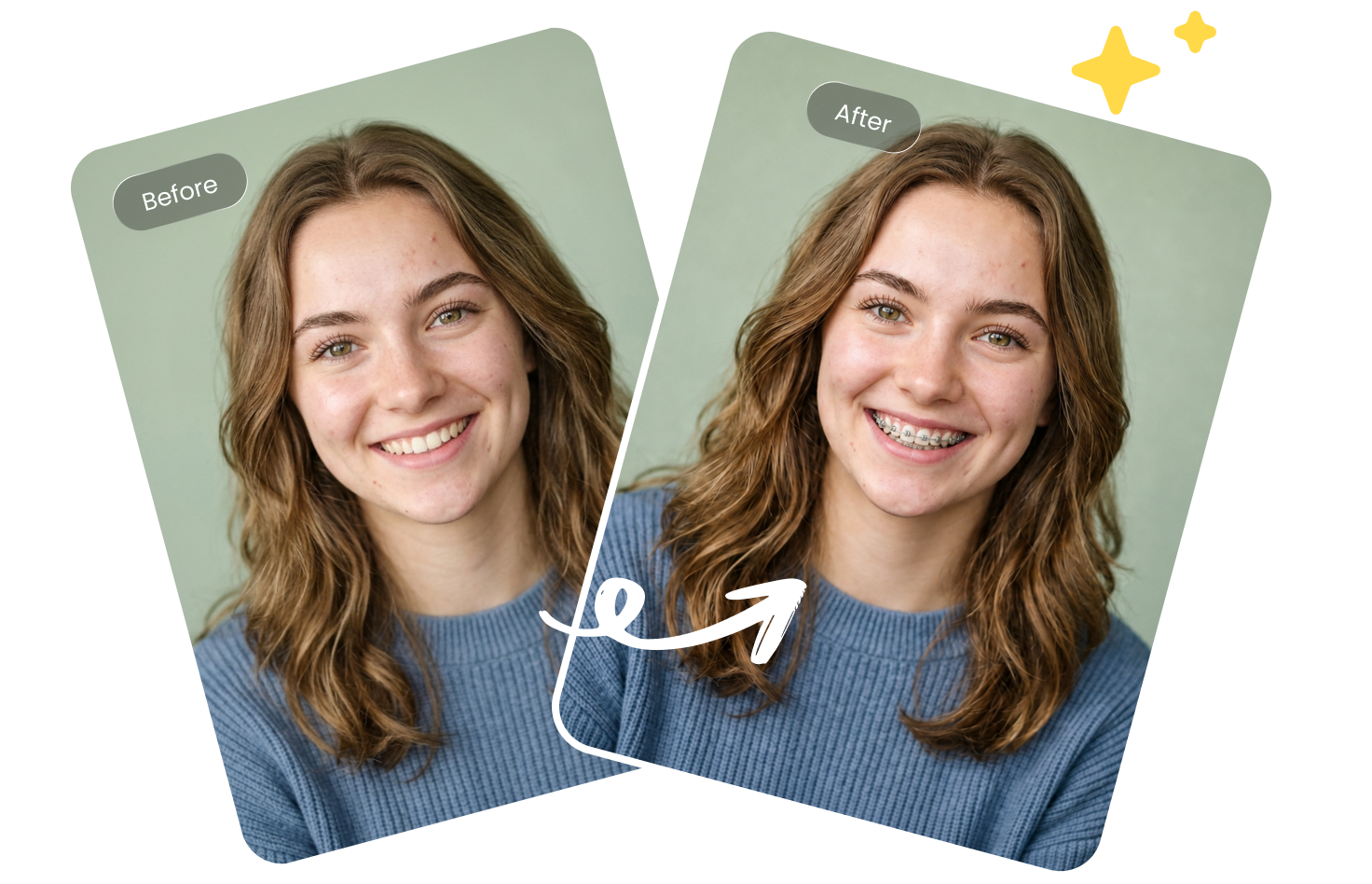 ai braces filter