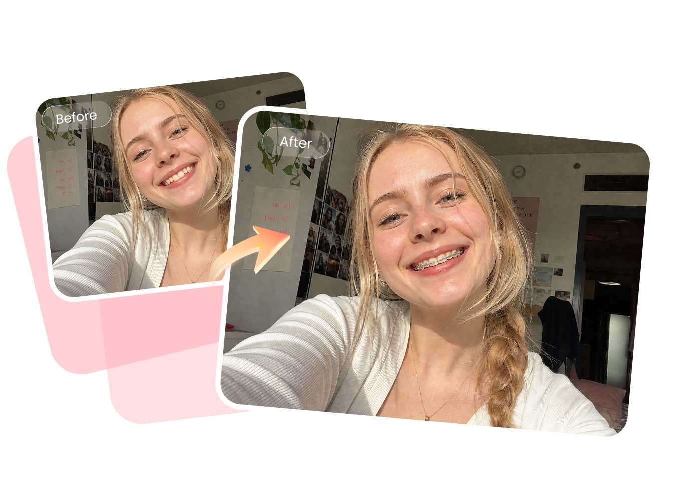 Braces try on filter helping users preview their smile before getting braces