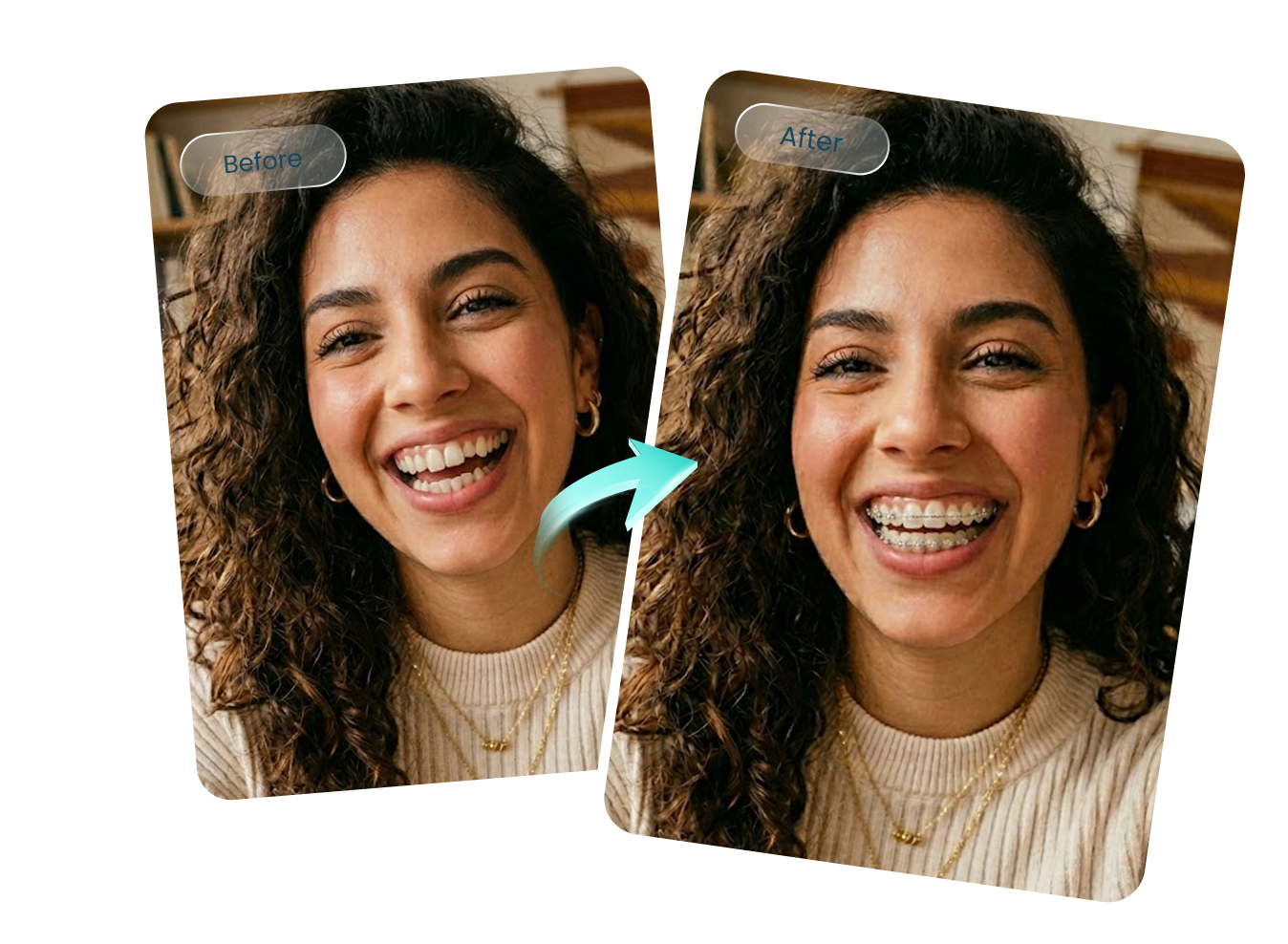 Realistic AI braces filter preserving facial features and natural smile appearance
